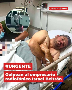 Golpean brutalmente a Israel Beltr&aacute;n, de la Radio de Ojinaga